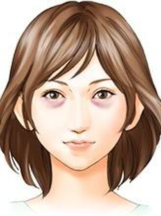 あなたの目、疲れていない!?クマの種類と解消法