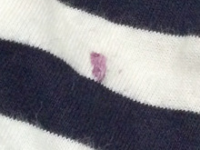 洋服についたブドウ(果物)系のシミ。これでほぼ取れるんです。