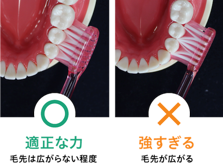 力任せの歯磨きはNG!「軽い力」で磨くべき理由とは
