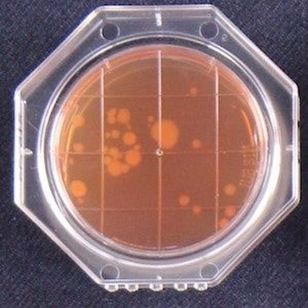 知らないうちに大腸菌があそこにも、ここにも!!