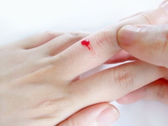 あきらめるのはまだ早い!血液のシミを洗濯でスッキリ落とすコツ