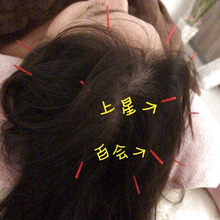 花粉症にはこのツボを!