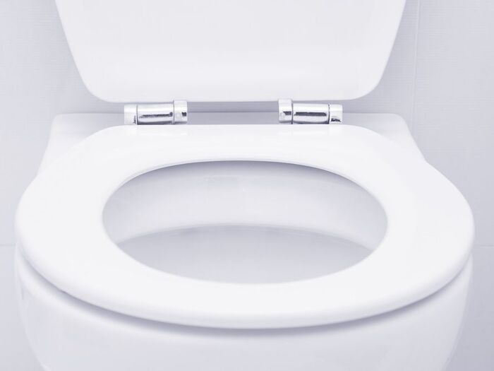 トイレの黄ばみはコレで落ちる!掃除方法から予防方法まで紹介