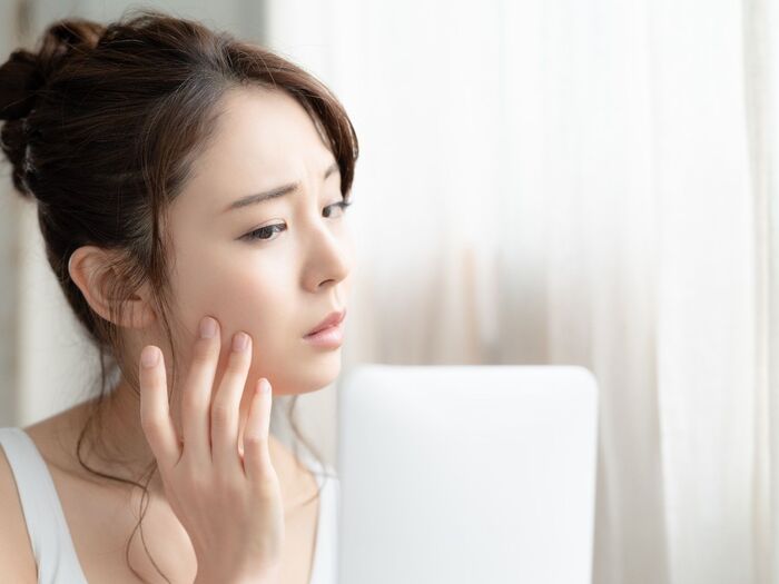 ニキビがあっても脱毛できるの?ニキビと脱毛の関係についてまとめました!