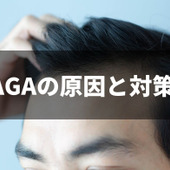 AGAの原因と対策を分かりやすく解説!