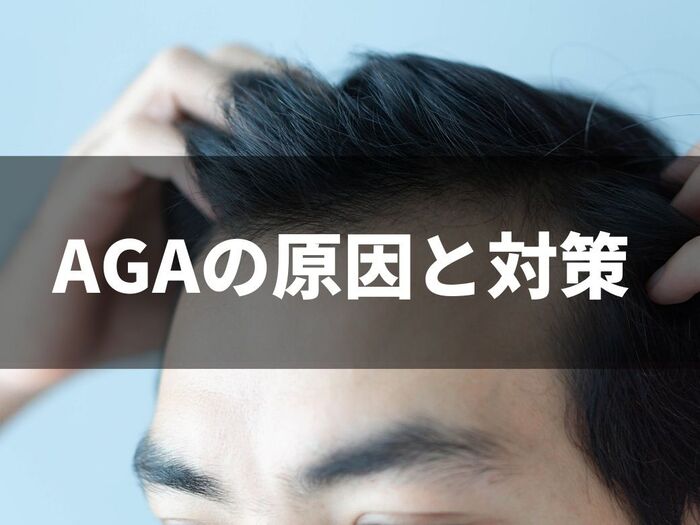 AGAの原因と対策を分かりやすく解説!