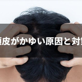 頭皮がかゆくなるのはなぜ?原因と対策を解説
