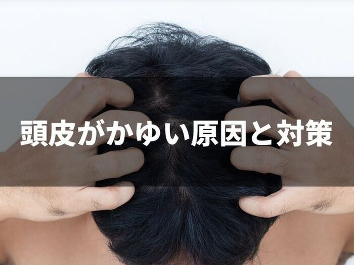頭皮がかゆくなるのはなぜ?原因と対策を解説