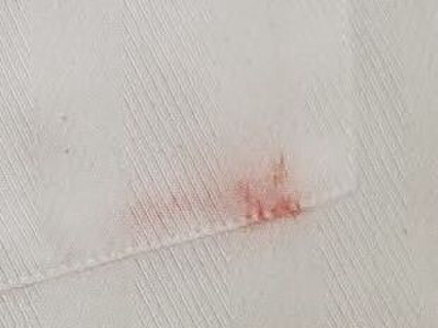 1年前にベンジンで叩き出して一回洗濯したけどインクが残って諦めたワイシャツのポケット