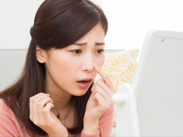 1月は「大人ニキビ」が増えやすい?原因や対策方法を解説!