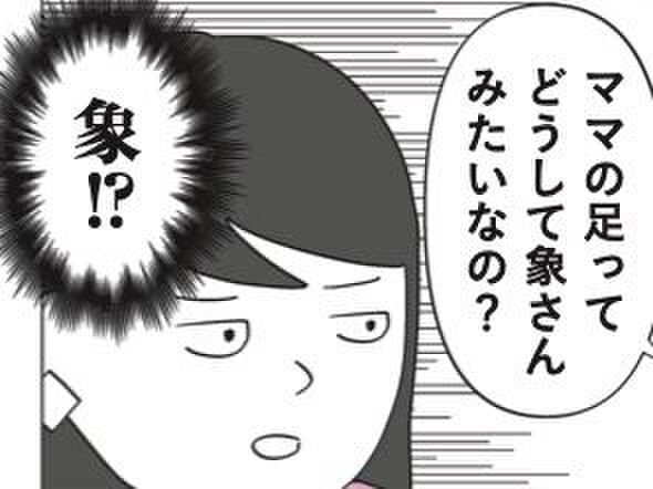 むくみが出てるのは心臓より上か下か!ハイどっち!?【10秒筋膜ほぐしマンガ #25】