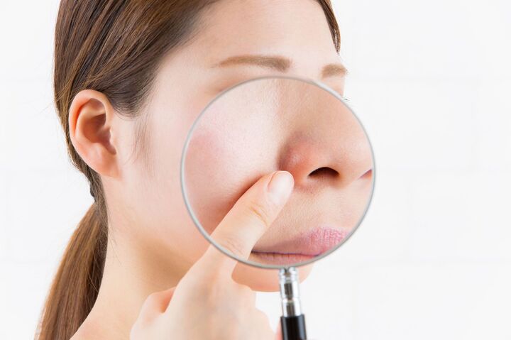 化粧のりが悪いのは「毛穴」が原因!?毛穴のタイプ別ケアのポイント