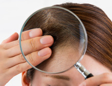 かゆみや抜け毛…冬の「頭皮トラブル」、改善するにはどうしたら？