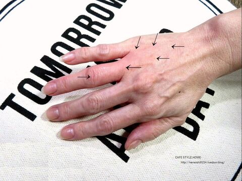 閲覧注意 蜂に刺された時の行動と我が家の恐怖体験 暮らしニスタ 閲覧注意 蜂に刺された時の行動と我が家の恐怖体験 暮らしニスタ