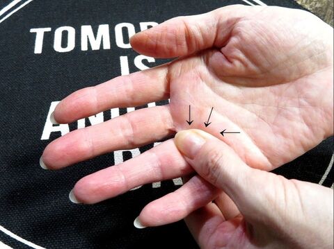 スズメバチ ハチに刺された体験記2 スズメバチに刺されること2度目 蜂駆除のルイワン