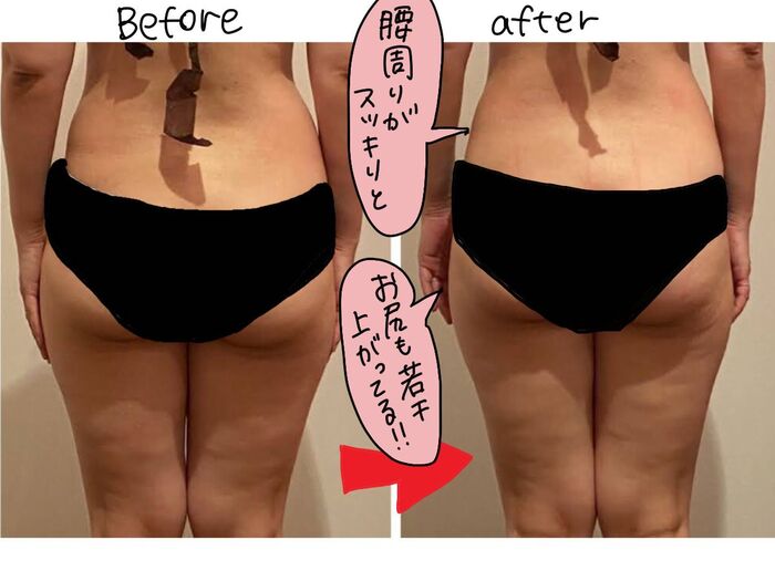 マンガ めちゃ体を張った わがままボディに筋膜リリースは効果あり 後編 暮らしニスタ めちゃ体を張った わがままボディ に筋膜 dメニューニュース Nttドコモ