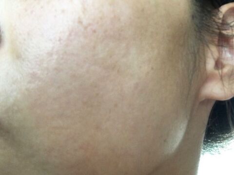 2wayで最強 ケノンの美顔器とは 実際に使って効果検証してみた 暮らしニスタ 2wayで最強 ケノンの美顔器とは 実際に使って効果検証してみた 暮らしニスタ