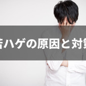 まだ20代なのになぜ…？若ハゲの原因と対策