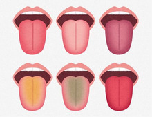 あなたはどのタイプ？「舌」で健康状態まるわかり！？セルフチェック&タイプ別対処法【薬剤師監修】