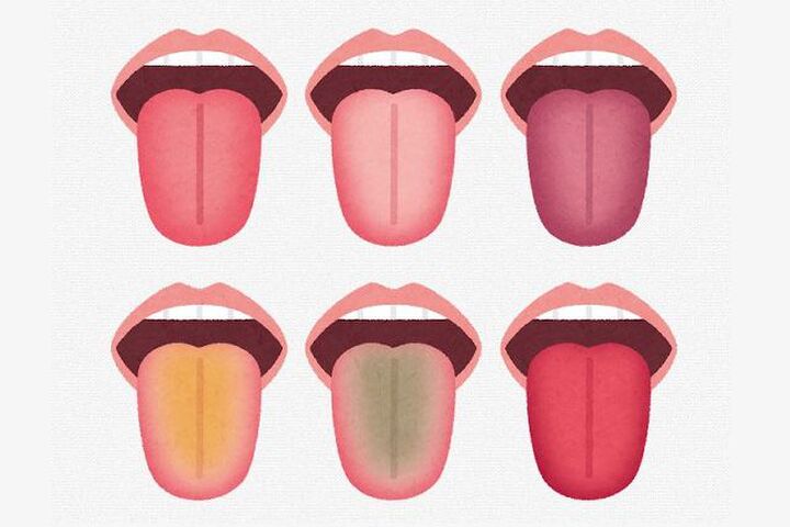 あなたはどのタイプ？「舌」で健康状態まるわかり！？セルフチェック&amp;タイプ別対処法【薬剤師監修】