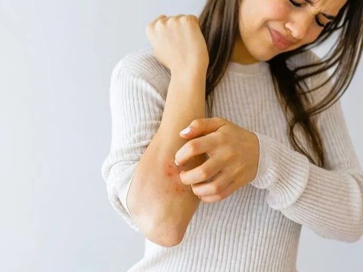 冬じゃないのに〈激しい乾燥〉がつらすぎる!原因と、かゆみをやわらげる方法をご紹介