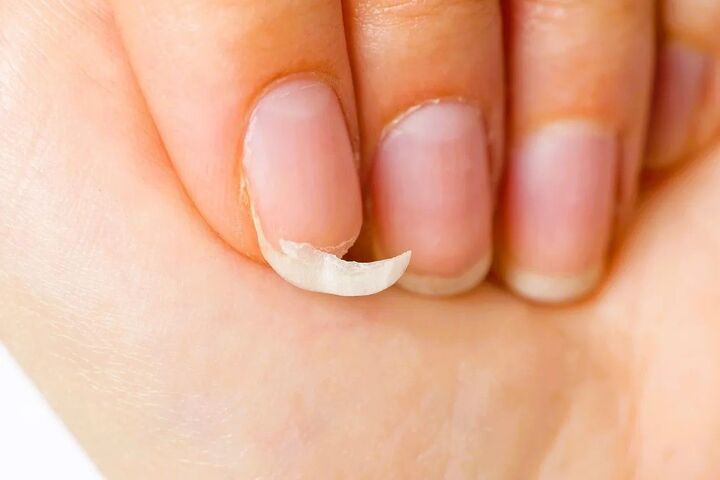 「最近、爪が割れやすい…」は放置厳禁!爪を丈夫にする意外な方法
