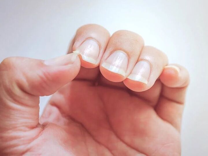 【爪診断】縦に筋がある人や、反っている人は要注意。体の隠れトラブルをチェック!