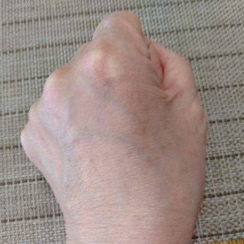 私の手の甲
