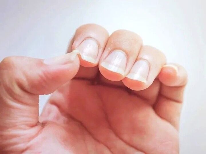 【爪診断】縦に筋がある人や、反っている人は要注意。体の隠れトラブルをチェック!