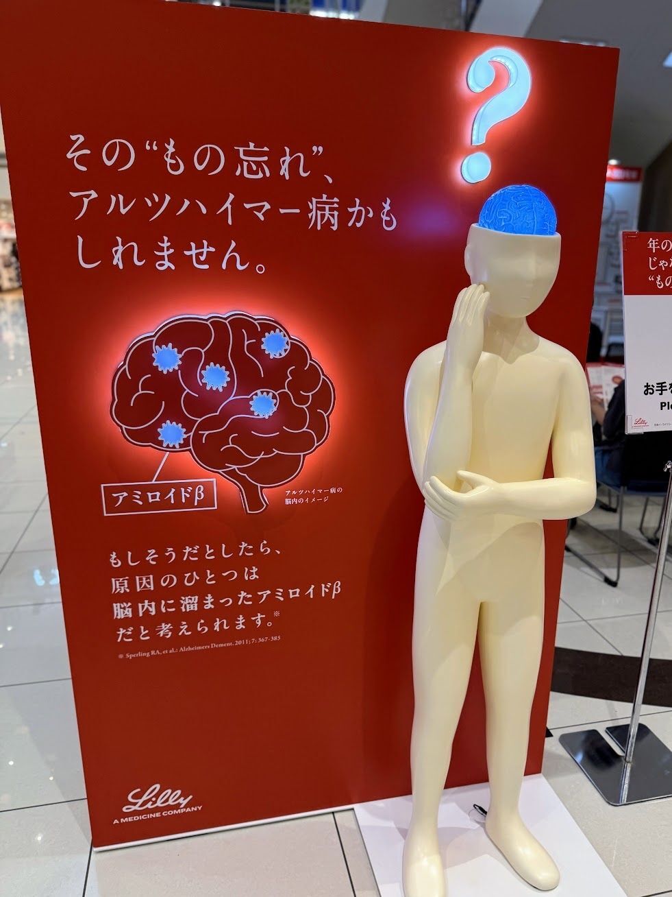 「これって年のせい？それともアルツハイマー病？」知っておきたいもの忘れの初期症状と脳からのサイン