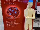 「これって年のせい？それともアルツハイマー病？」知っておきたいもの忘れの初期症状と脳からのサイン